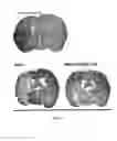 Fig. 12 - METHODS OF REDUCING BRAIN CELL APOPTOSIS