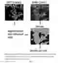 Fig. 02 - Pyrazolopyridazines and methods for treating retinal-degenerative diseases and hearing loss associated with usher syndrome
