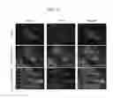 Fig. 33 - NANOEMULSION THERAPEUTIC COMPOSITIONS AND METHODS OF USING THE SAME
