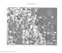 Fig. 07 - CRYSTALS OF LAQUINIMOD SODIUM AND IMPROVED PROCESS FOR THE MANUFACTURE THEREOF