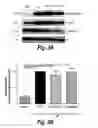 Fig. 04 - PYRIMIDINE HYDROXY AMIDE COMPOUNDS FOR TREATING PERIPHERAL NEUROPATHY