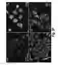 Fig. 07 - PYRIMIDINE HYDROXY AMIDE COMPOUNDS FOR TREATING PERIPHERAL NEUROPATHY