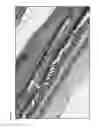 Fig. 02 - METHODS OF PREVENTING, REDUCING OR TREATING MACULAR DEGENERATION