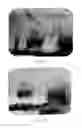 Fig. 08 - Laser assisted wound healing protocol and system