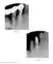 Fig. 09 - Laser assisted wound healing protocol and system