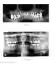 Fig. 10 - Laser assisted wound healing protocol and system