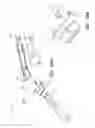 Fig. 15 - Laser assisted wound healing protocol and system