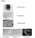 Fig. 06 - METHOD AND APPARATUS FOR RECOVERY OF UMBILICAL CORD TISSUE DERIVED REGENERATIVE CELLS AND USES THEREOF