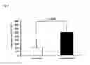 Fig. 04 - EXERCISE FUNCTION ENHANCER
