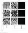 Fig. 06 - GLYCOSYLATED PROTEIN OF AN EXTRA-CELLULAR MATRIX FOR USE IN A METHOD OF TREATING AN ISCHEMIC HEART OF A HUMAN OR ANIMAL SUBJECT IN NEED THEREOF