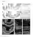 Fig. 11 - GLYCOSYLATED PROTEIN OF AN EXTRA-CELLULAR MATRIX FOR USE IN A METHOD OF TREATING AN ISCHEMIC HEART OF A HUMAN OR ANIMAL SUBJECT IN NEED THEREOF