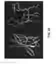 Fig. 46 - Methods for treating dermatomyositis or polymyositis by administering a soluble CTLA4 molecule