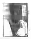 Fig. 02 - DEVICE AND METHOD FOR THE DELIVERY OF DRUGS FOR THE TREATMENT OF POSTERIOR SEGMENT DISEASE