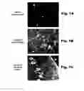 Fig. 02 - METHODS AND COMPOSITIONS FOR CNS DELIVERY OF IDURONATE-2-SULFATASE