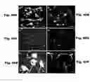 Fig. 34 - METHODS AND COMPOSITIONS FOR CNS DELIVERY OF IDURONATE-2-SULFATASE