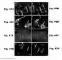 Fig. 41 - METHODS AND COMPOSITIONS FOR CNS DELIVERY OF IDURONATE-2-SULFATASE
