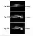 Fig. 51 - METHODS AND COMPOSITIONS FOR CNS DELIVERY OF IDURONATE-2-SULFATASE