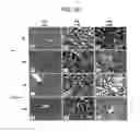 Fig. 17 - Immunopotentiative composition