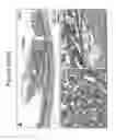 Fig. 12 - MODEL OF COLORECTAL CANCER