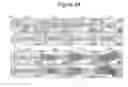 Fig. 22 - MODEL OF COLORECTAL CANCER