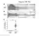 Fig. 24 - MODEL OF COLORECTAL CANCER