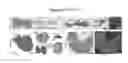 Fig. 26 - MODEL OF COLORECTAL CANCER