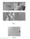Fig. 04 - Liposomal drug delivery system for bone cements