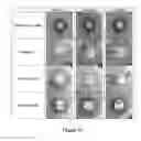 Fig. 08 - Liposomal drug delivery system for bone cements