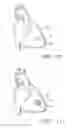 Fig. 07 - Anisotropic Constructs and Methods for Forming and Using Same for Treating Damaged Biological Tissue
