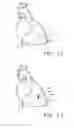 Fig. 08 - Anisotropic Constructs and Methods for Forming and Using Same for Treating Damaged Biological Tissue