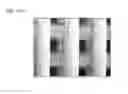 Fig. 18 - Scaffold for hard tissue regeneration containing active ingredient for treating osteoporosis and preparing method thereof