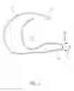 Fig. 03 - APPARATUS FOR BLOOD CONCENTRATION