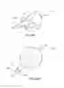 Fig. 30 - Device and methods for transvascular tumor embolization with integrated flow regulation