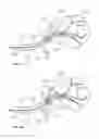 Fig. 34 - Device and methods for transvascular tumor embolization with integrated flow regulation