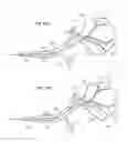 Fig. 40 - Device and methods for transvascular tumor embolization with integrated flow regulation