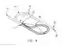 Fig. 10 - System for detecting and removing a gas bubble from a vascular infusion line