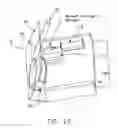 Fig. 24 - System for detecting and removing a gas bubble from a vascular infusion line
