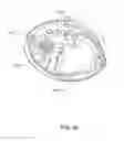 Fig. 105 - Adhesive and peripheral systems and methods for medical devices