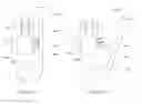 Fig. 123 - Adhesive and peripheral systems and methods for medical devices