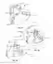 Fig. 04 - FACIAL MASK WITH INTERNAL SUPPORT STRUCTURE FOR USE WITH VENTILATION AND POSITIVE AIR PRESSURE SYSTEMS