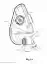 Fig. 06 - MODULAR PULMONARY TREATMENT SYSTEM