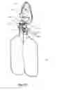 Fig. 10 - MODULAR PULMONARY TREATMENT SYSTEM
