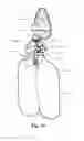 Fig. 11 - MODULAR PULMONARY TREATMENT SYSTEM