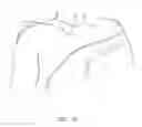 Fig. 34 - Methods and apparatus for administering local anesthetic