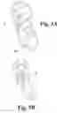 Fig. 06 - Mechanical device for soothing agitated patients