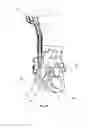 Fig. 09 - Self-expanding cannula