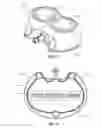 Fig. 07 - Indicia Informative of Characteristics of Insertable Medical Devices
