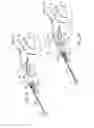 Fig. 03 - Robotic catheter system