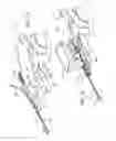 Fig. 13 - Robotic catheter system