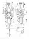 Fig. 07 - Steering control mechanism for catheters
